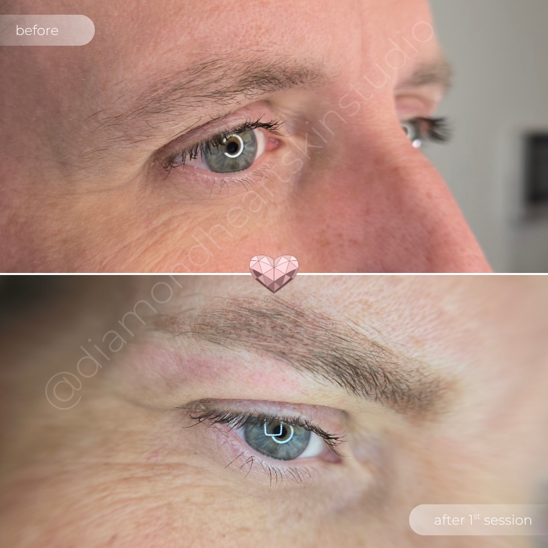 Gender-affirming brow PMU before and after result