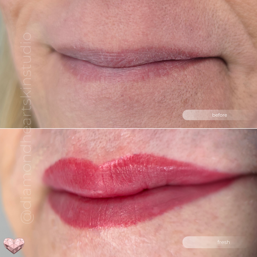 Before and after close-up of lips enhanced with a red-toned lip blush gender affirming tattoo
