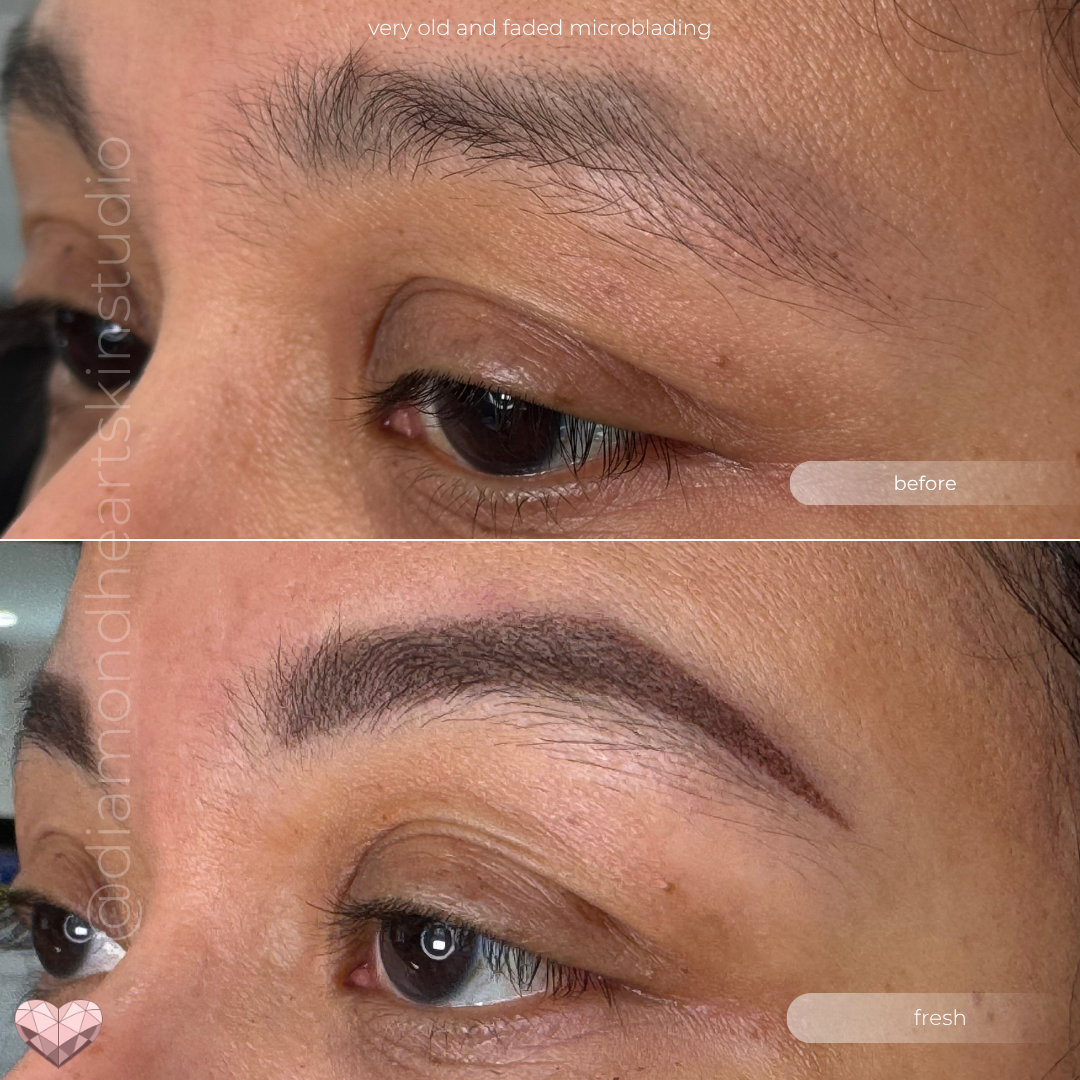 Before and after of faded powder brow tattoo refreshed with new pigment.