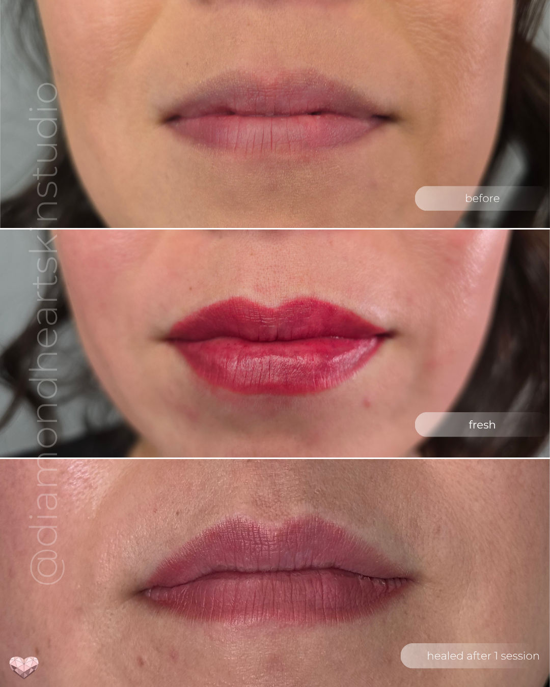 Before, fresh, and healed comparison of lip blush tattoo in deep red tone