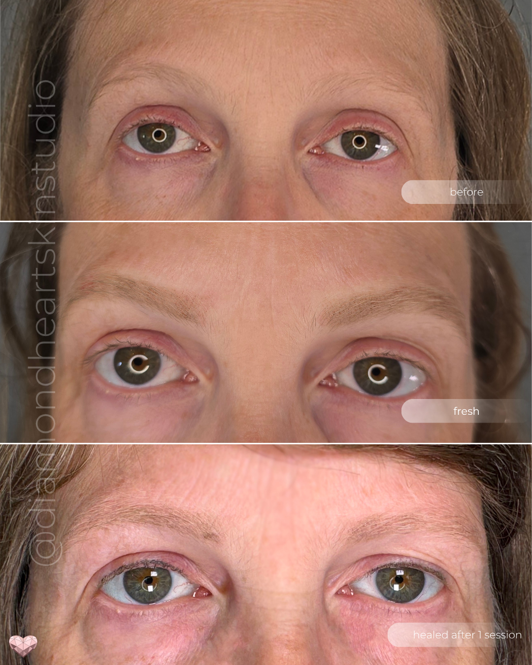 Before, fresh, and healed comparison of powder brow tattoo results